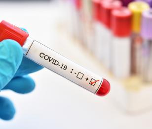 appel aux dons covid 19